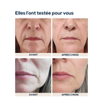 Cure peau repulpée