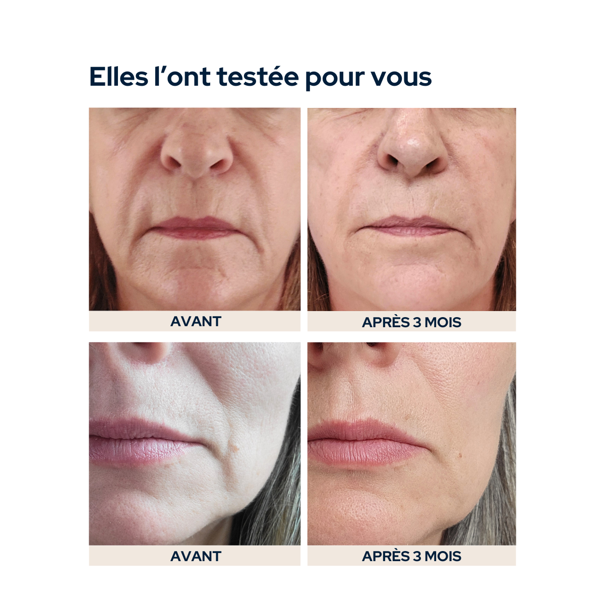 Cure peau repulpée