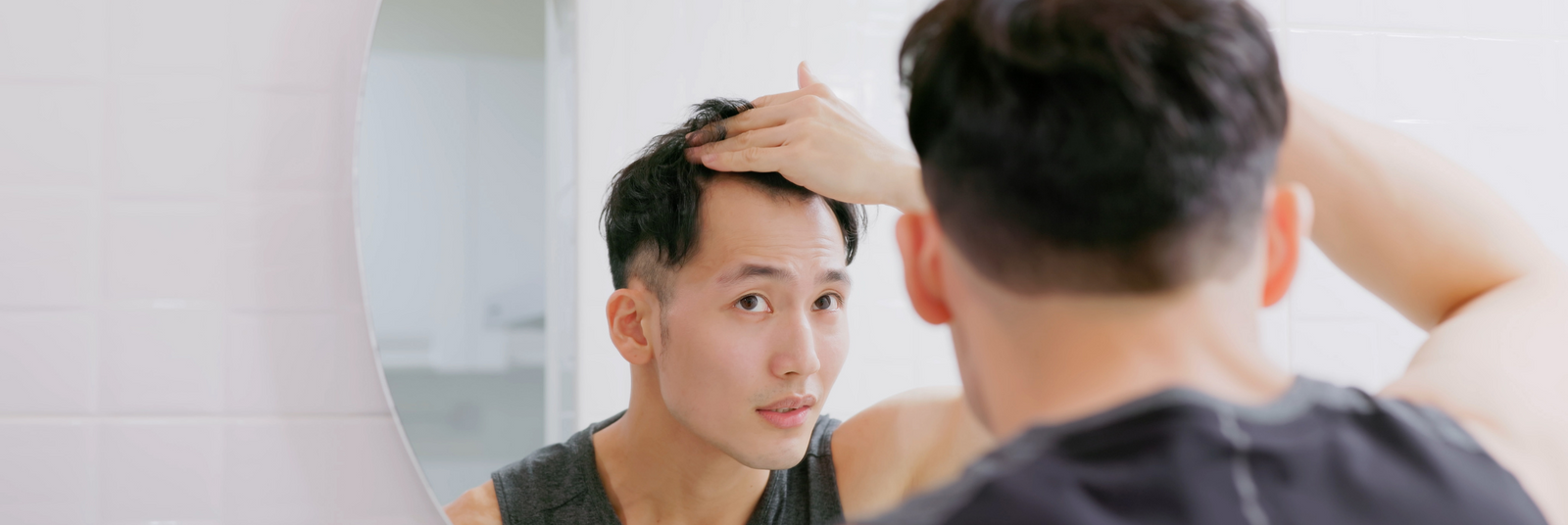 Alopécie androgénétique : comment y échapper ?