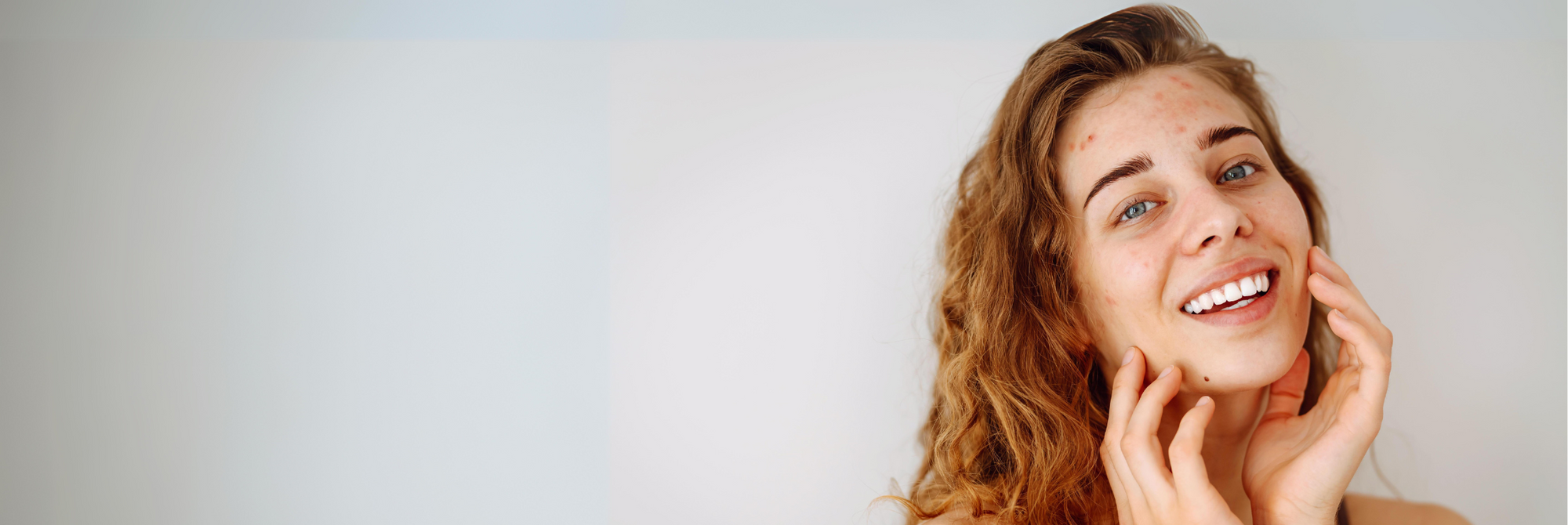 Les différents types d'acné