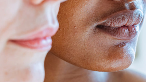 Imperfections et alimentation : faisons de notre assiette un allié belle peau