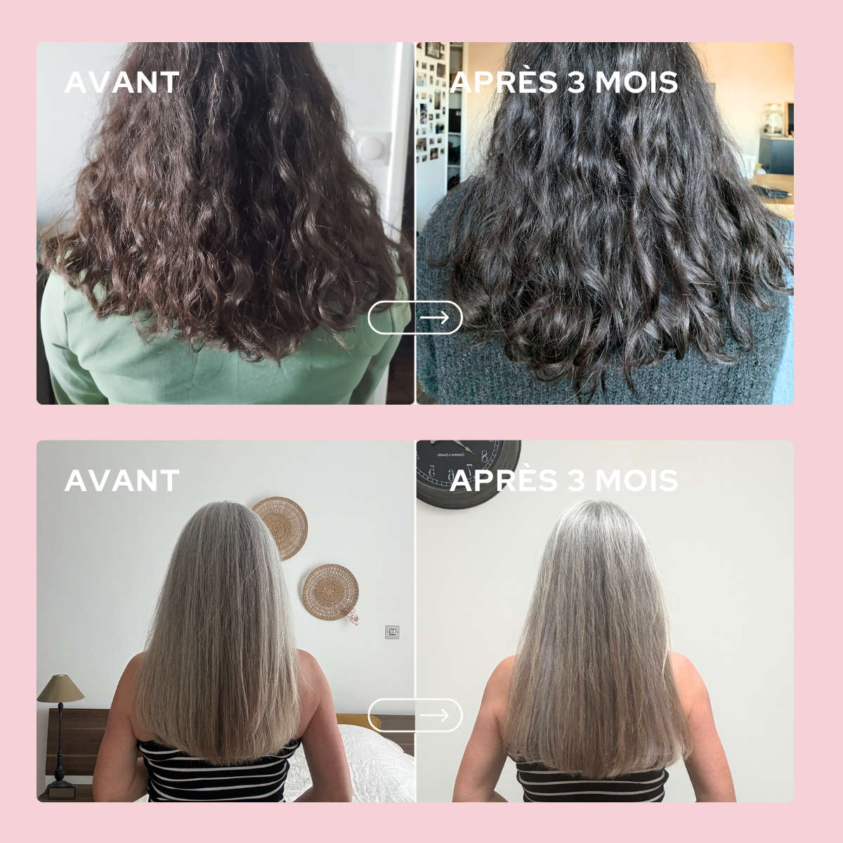 Gummies cheveux & ongles