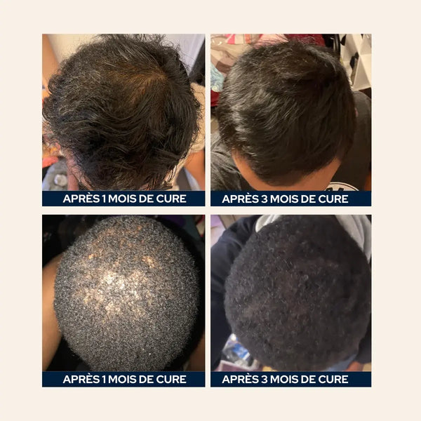 19 hommes ont testé la cure pendant 3 mois